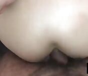 Dilatation anale au réveil